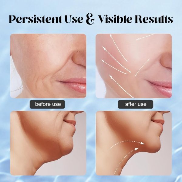 Massager For Face Lifting Facial Massagers Ems Neck
