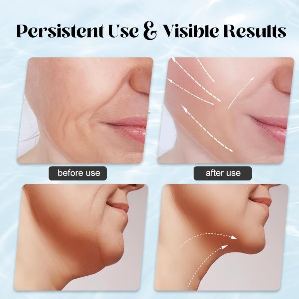 Massager For Face Lifting Facial Massagers Ems Neck