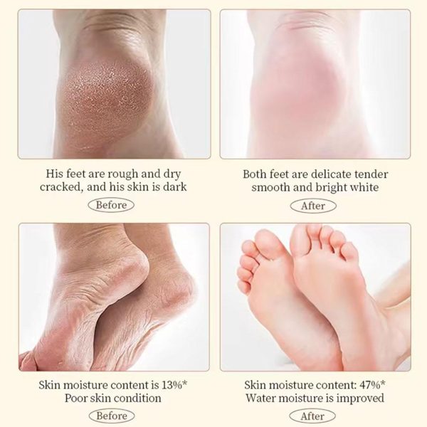 Sadoer Hand Foot Cream โ 60gram Hand Foot Cream Moisturizing Calluses Dead Skin